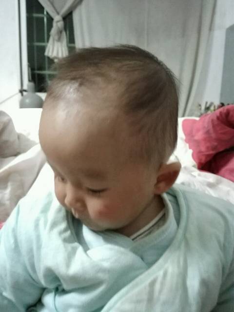 宝宝天灵盖鼓起来的!_宝宝八个月,天灵盖还没