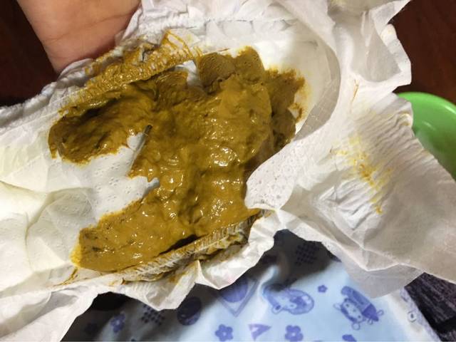 宝宝五六天才拉一次大便,而且很臭,颜色看起来
