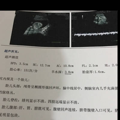 问答 怀孕期 树友a0dv74qu孕22周1天2017-01-04 推荐回答