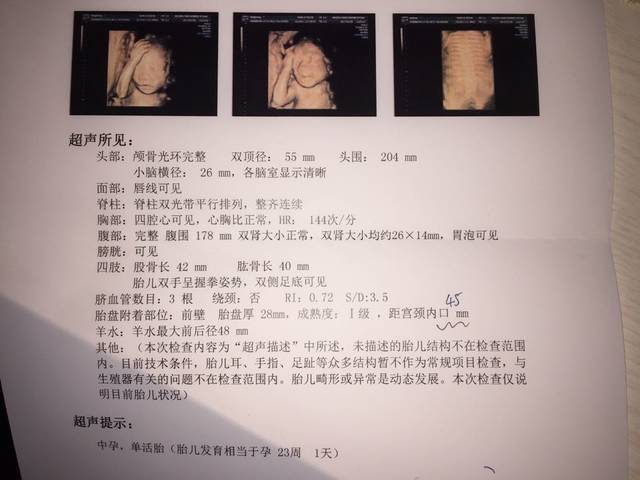 四维彩超两次通过,22周+5天_今天下午去做的