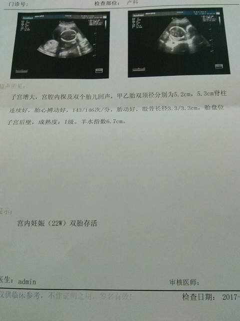 宝妈帮忙看看_22周的b超单,双胎看看是男宝还是女宝??_宝宝树