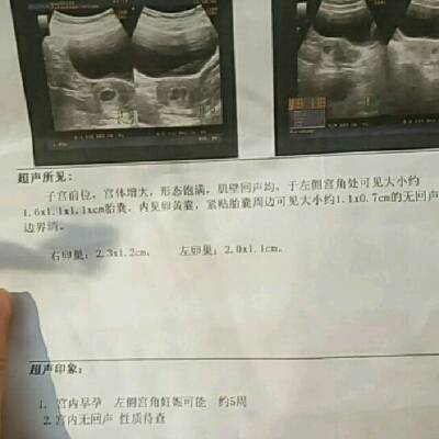 怀孕5周多了,肚子总是下坠,不舒服,伴有深褐色