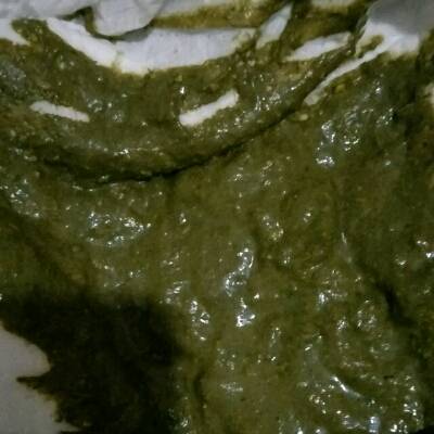 宝宝4个月12最近几天有点感冒去医院看了医生