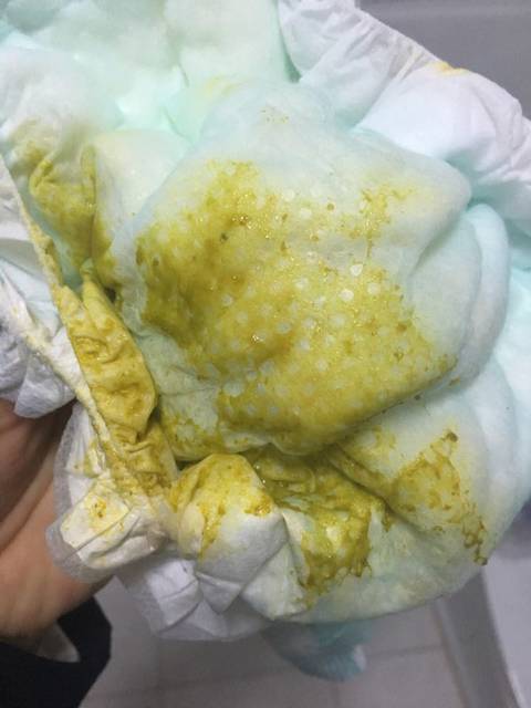 什么是纯母乳喂养_
