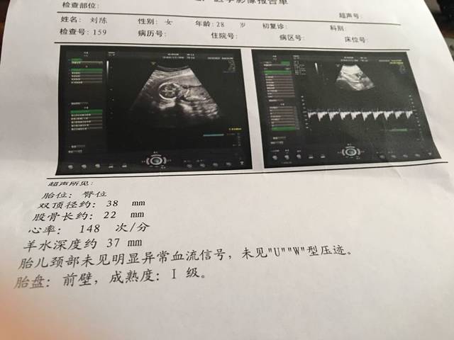 帮忙看男女啦_怀孕4个月的B超图,帮忙看下啦