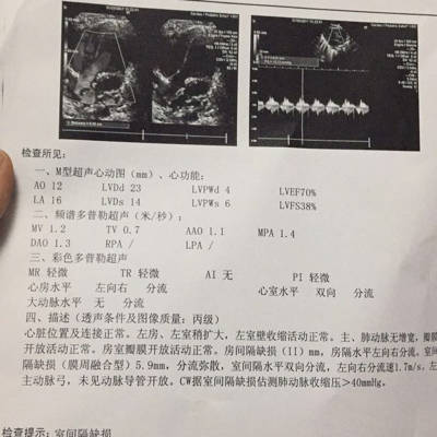 宝宝46天检查出心脏室缺5.9毫米,房缺1.2毫米