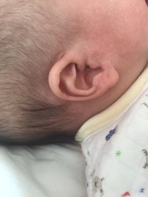 宝宝耳朵堵了…_今天看了看宝宝耳朵,好多发黄