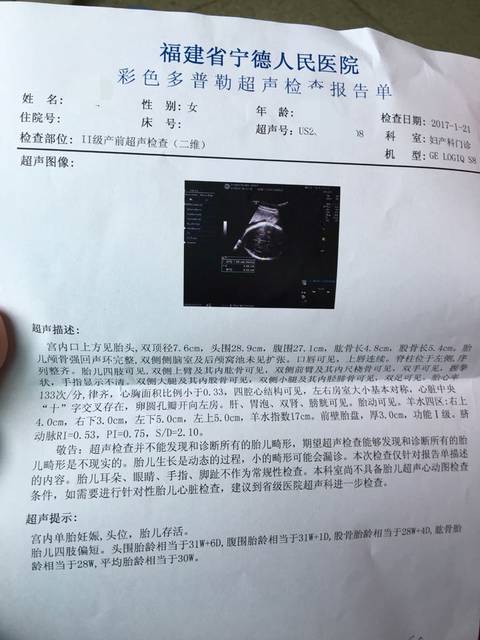 B超显示胎儿四肢偏短两周_30周加1天B超显示