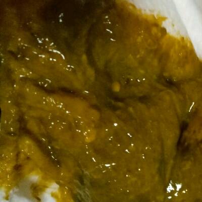 婴儿两个月,最近半个月老是吐奶,大便粘,里面有