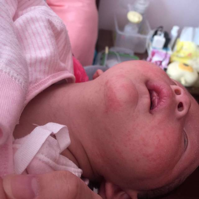 戒之馆的婴亲霜有用过的吗?求分享!_宝宝之前