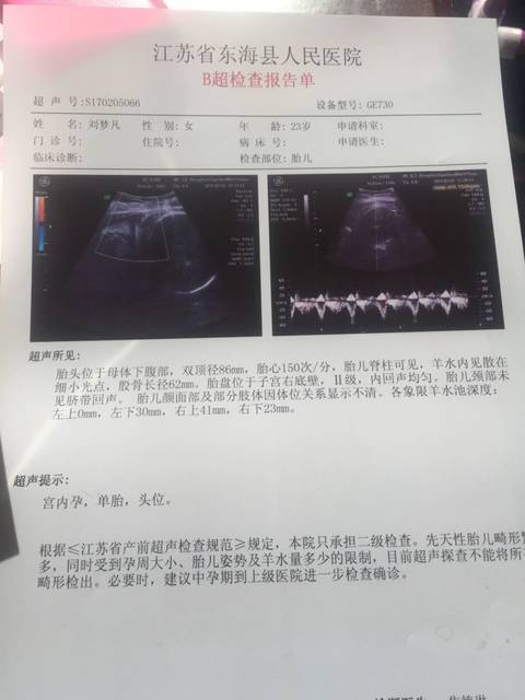 医生说宝宝腿短_353的B超检查单,医生说宝宝