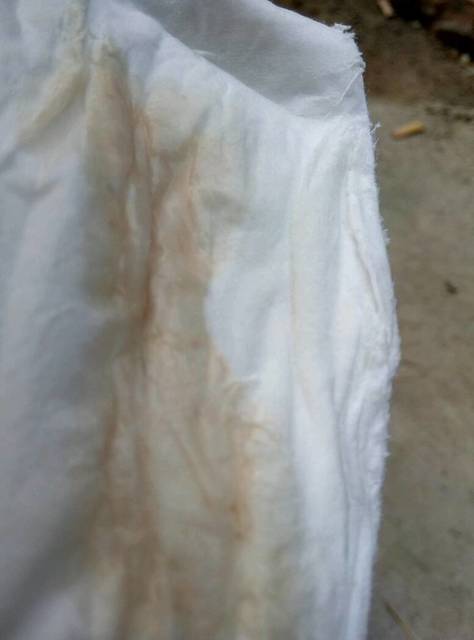 有经验的宝妈帮我看看_孕晚期,昨天检查胎盘3