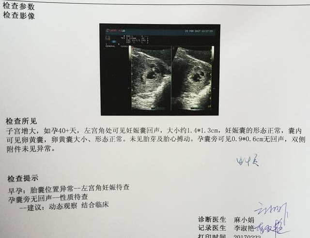 左宫角妊娠_好害怕,怎么办,会慢慢正常吗_宝宝树