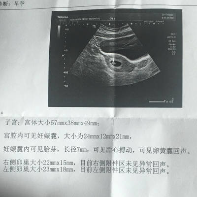 麻烦懂妊娠囊数据看男女的宝妈们,我这个单子是男宝还是女宝呢?