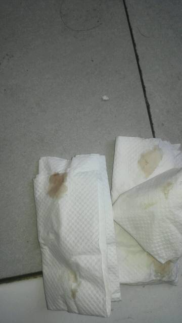 !_怀孕六周,刚刚上厕所擦了有褐色分泌物~肚子