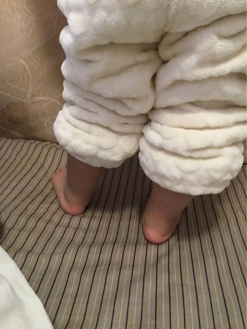 这是不是足外翻啊_宝贝现在1周3多,最近发现她