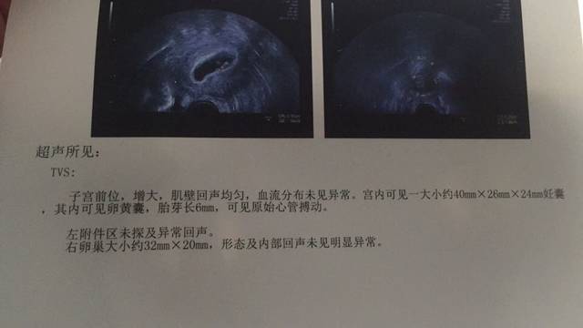 热乎乎的胎心胎芽_刚查的,末次1.12,期间一直断