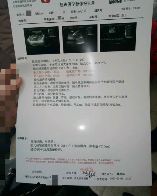 NT通过啦 宝宝真给力!_nt通过 胎儿发育很好 等