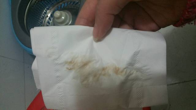 孕初期流褐色分泌物_2.6号末次姨妈,周六就测