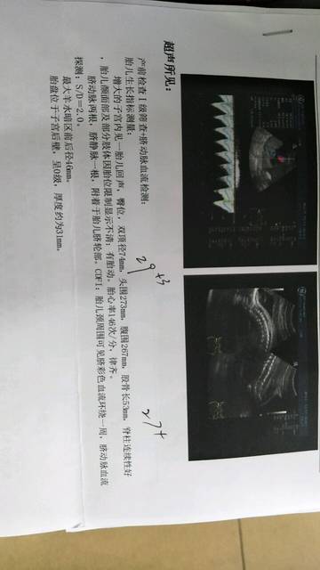 胎儿体重怎么计算的?_怎么样才知道胎儿的体