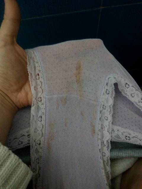 求助…怀孕6周+4有褐色分泌物腹部偶尔刺痛什