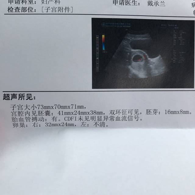 9周胎心胎芽_7周没有检查到胎心胎芽,紧张了一