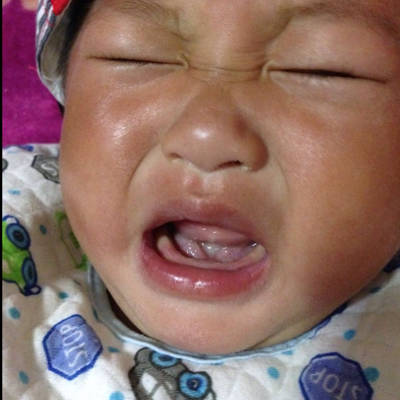 宝宝七个月,最近发现舌头底下有两瓣肉,不知道