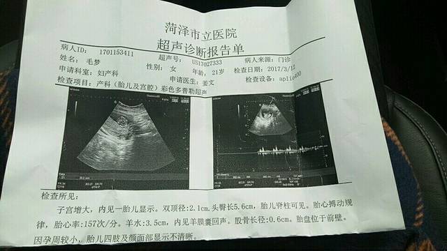 NT检查_怀孕3个月做的b超,是不是羊水太少了