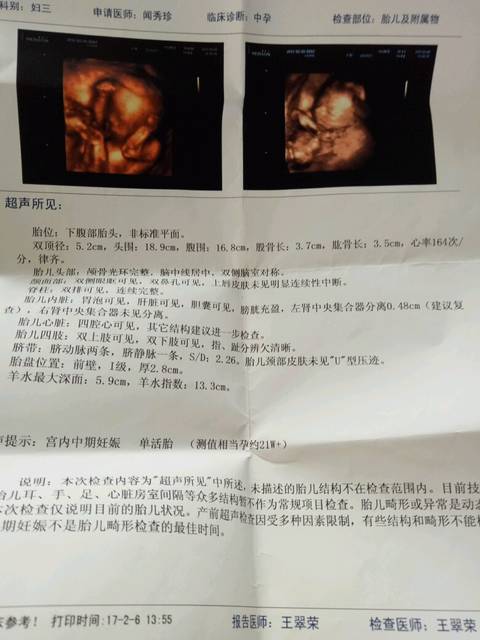胎检说胎儿左肾窦分离0.58cm是什么意思_