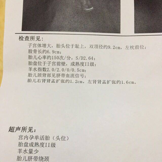 宝宝双肾积水_孕37周,检查宝宝双肾积水,怎么