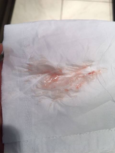 怀孕四十天_怀孕四十天小肚子有点不舒服,伴有