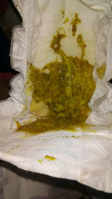 急急,帮我看看,20天宝宝拉的大便