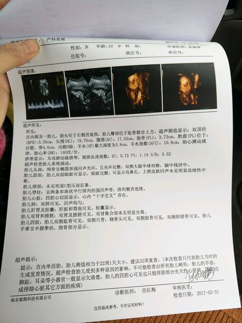 不是双肾未见分离是女孩子吗?_而且说四维单