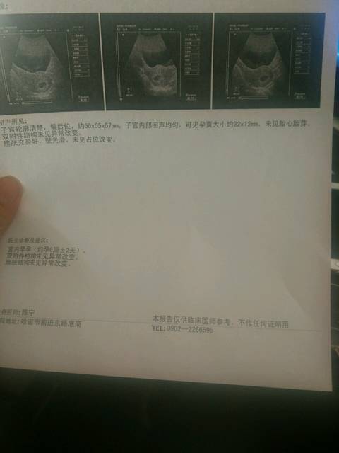 B超40几天,能天男女么_最后一次月经2月24号