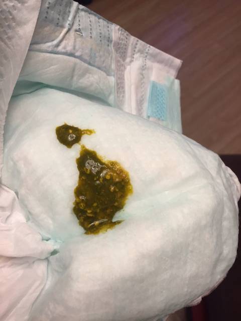 宝宝大便是绿色?_宝宝出生7天突然大便绿色里