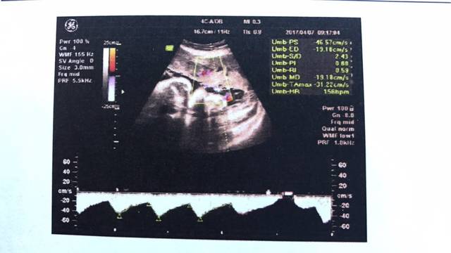 姑姑是医生,B超单看男女啦_准妈妈们,我怀孕的
