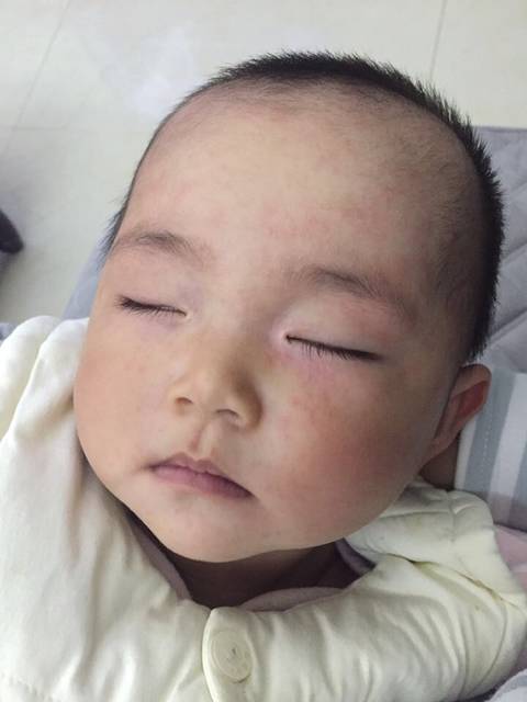 有没有宝宝急疹的?_前两天宝宝突然发烧,但是