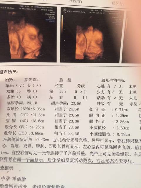 各位准妈妈帮我看看哟_帮我看看四维单是男孩