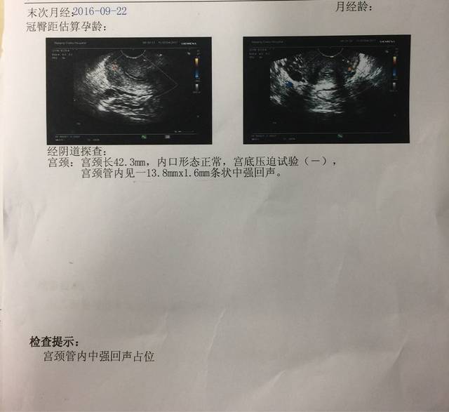 怀孕七个月发现宫颈息肉_六个月时总是断断续