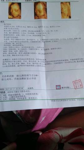 b超单子看男女