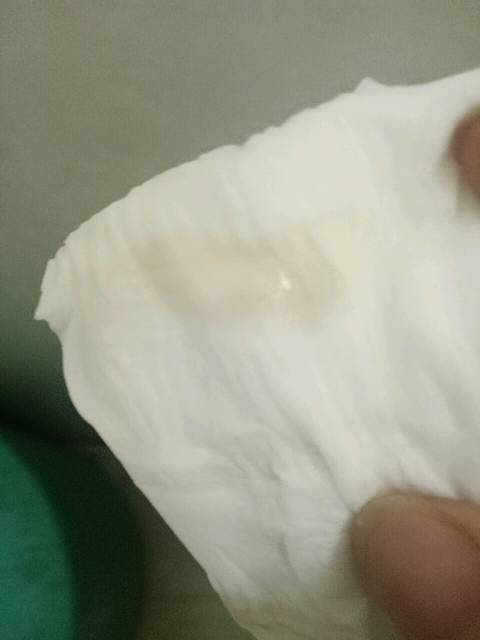 怀孕6周出褐色分泌物有图!_肚子不疼也不闹,就