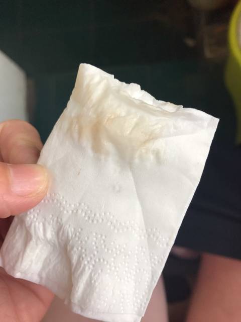 孕早期褐色分泌物，大家都来说说，我需要正能量!