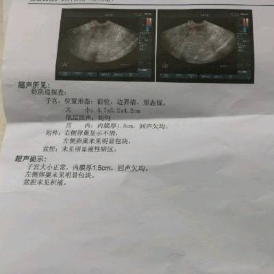 去年10月初宫外孕腹腔镜手术切除右侧输卵管