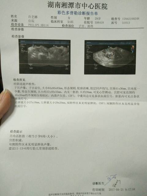宫内积液_从怀孕5周检查b超到9周分别都是宫