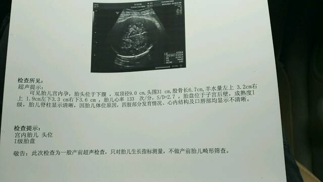 会计算体重的进_怀孕36周两天 双顶径9.0cm