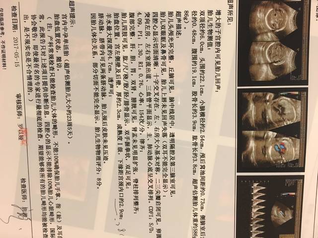 有种强烈感觉会是生妹妹_差一周满6个月了。