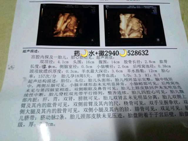24周四维彩超女孩,最后翻盘了。_真的太不可思