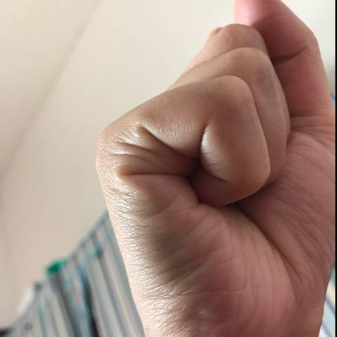 子女线