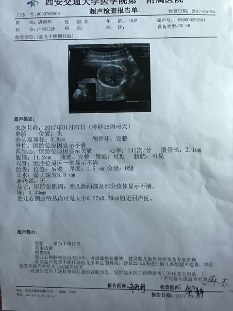 怀孕16周b超检查胎儿右侧脉络丛内无回声