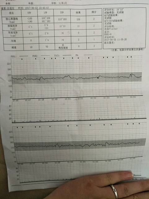 胎心监护图,大家帮忙看看是男孩女孩